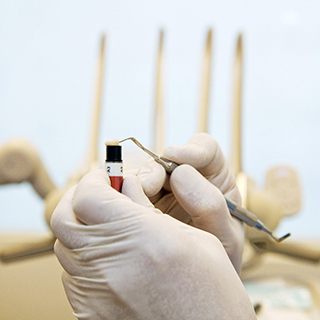 Dentist handling composite resin material with tools