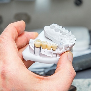Dental ceramist holding a model of the mouth with a dental bridge in Pembroke Pines