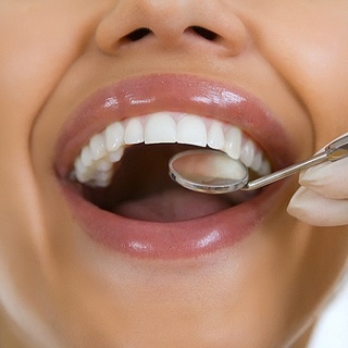 Close up of woman’s upper teeth and dental mirror