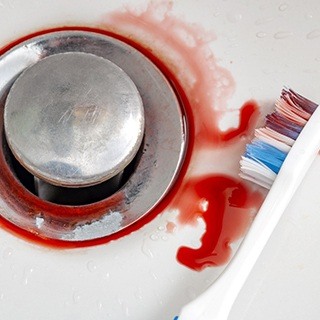blood swill in bathroom sink next to a toothbrush