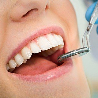Close up smile being examined by a dentist