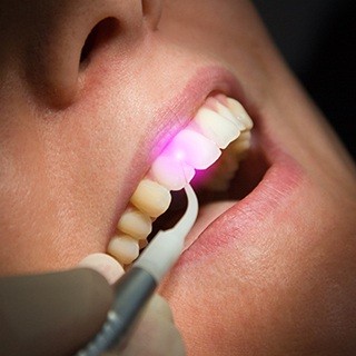 Patient receiving laser dentistry treatment