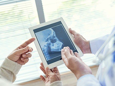 X-ray of jaw and skull bone on tablet computer