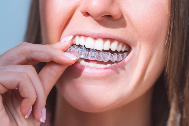 woman wearing SureSmile aligners